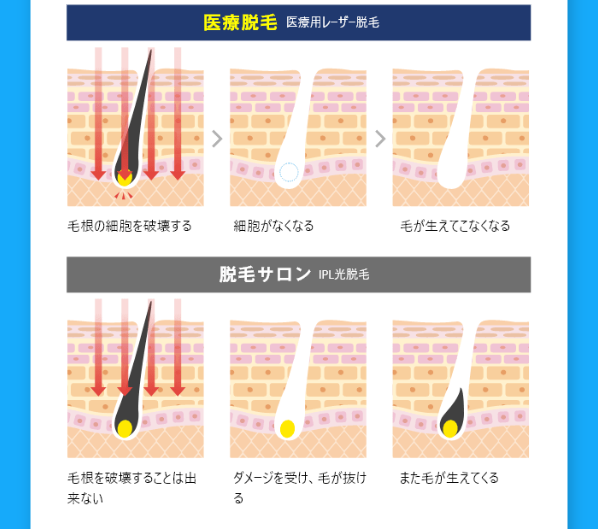 メンズリゼ10
