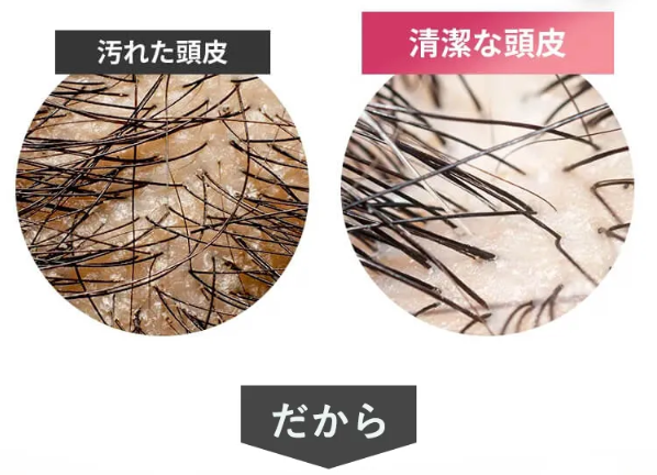 メルス41