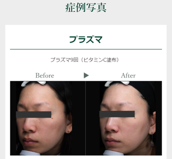 エトワールレジーナクリニック12