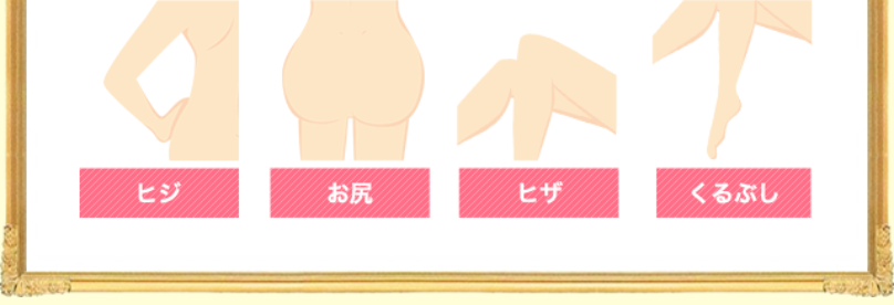 こだわり3気になる全身の黒ずみに3