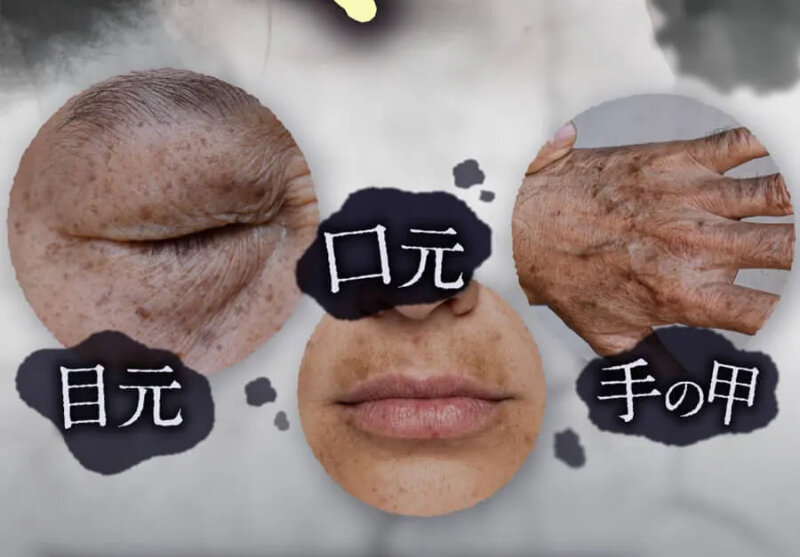 ドクターケシミー015