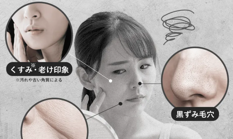 年齢とともに増える深刻な肌悩み-2