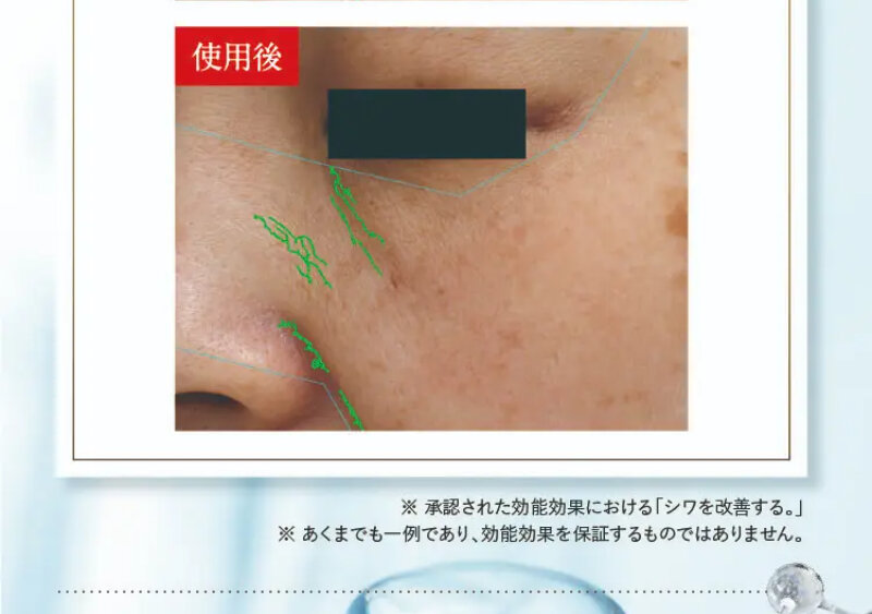 パルフェットnaセラム057