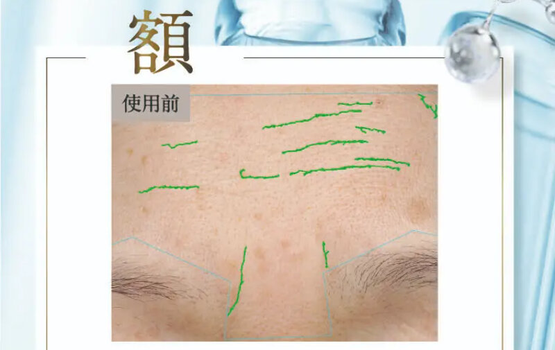 パルフェットnaセラム058