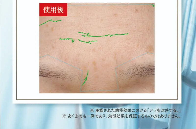 パルフェットnaセラム059