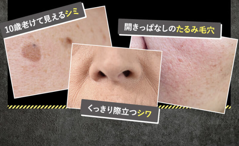 シルクリスタ075