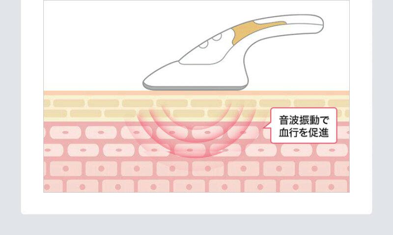 スキンアイロン058