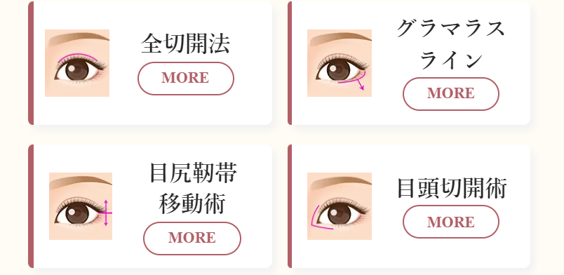 デカ目形成の7施術-2